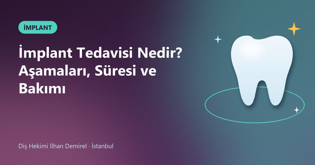 İmplant Tedavisi Nedir? Aşamaları, Süresi ve Bakımı – Dt. İlhan Demirel blog kapak görseli