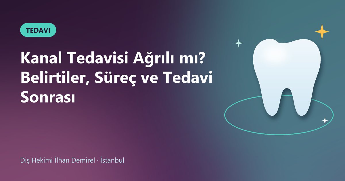 Kanal Tedavisi Ağrılı mı? Belirtiler, Süreç ve Tedavi Sonrası – Dt. İlhan Demirel blog kapak görseli